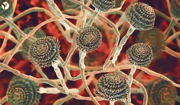 Aspergillus UK 2025