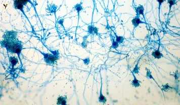 Killer Fungus Threat in the UK