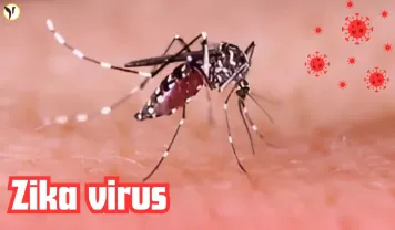 Zika virus 